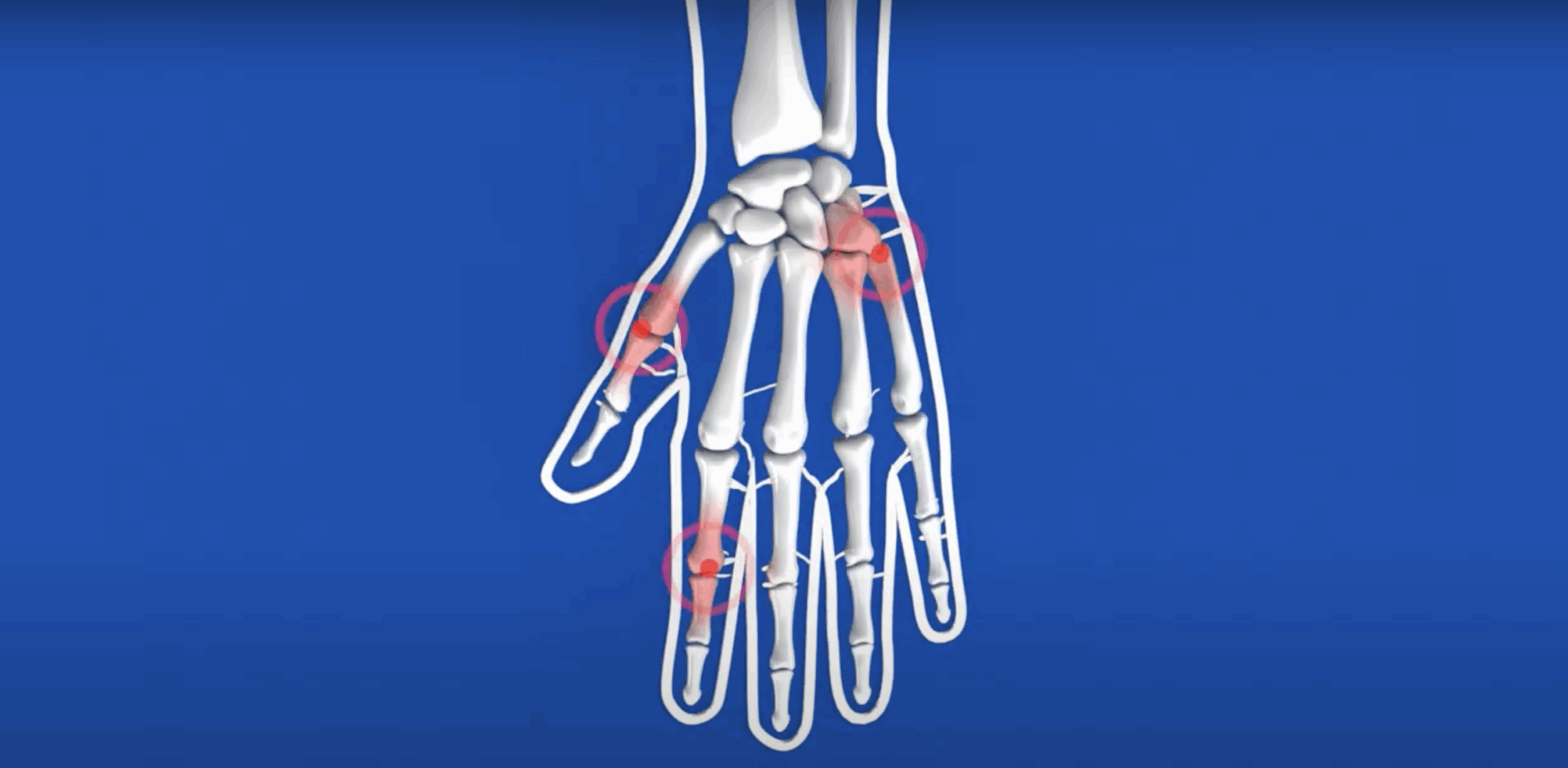 Protect Your Heart Against Aging with Ubiquinol